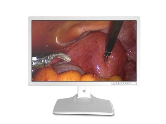 Медицинские Endoscopic аксессуары показывают 32inch