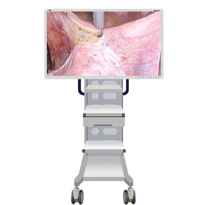 Медицинская камера монитора Endoscope с экраном 55inch