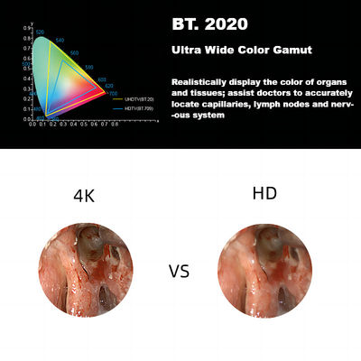 Система камеры Endoscope ДЕКАБРЯ 3840 a новая 4K ультра HD медицинская для лапароскопии